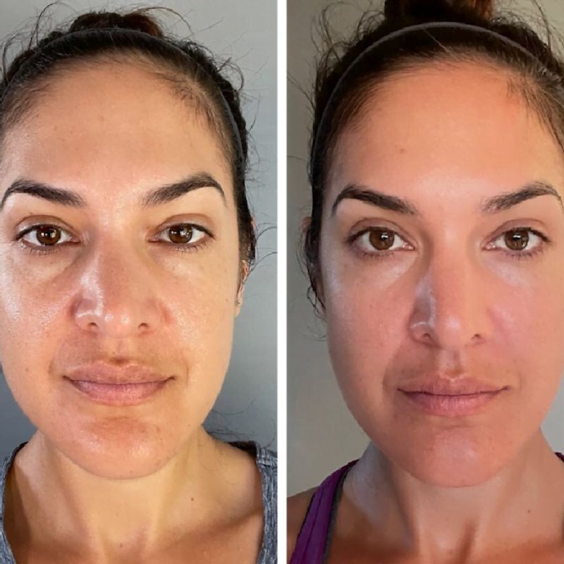 Rejuvenece tu piel sin esfuerzo con Zinnia™ 💎